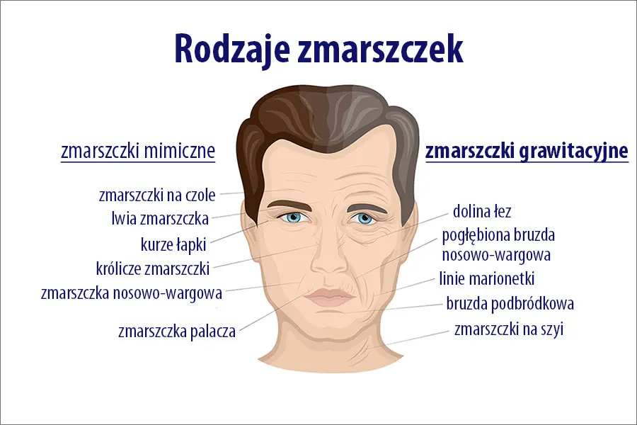 Botoks cena likwidacji zmarszczek w Warszawie